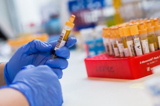 Hygienici eviduju rodinne epidemie a zltacku v Leviciach