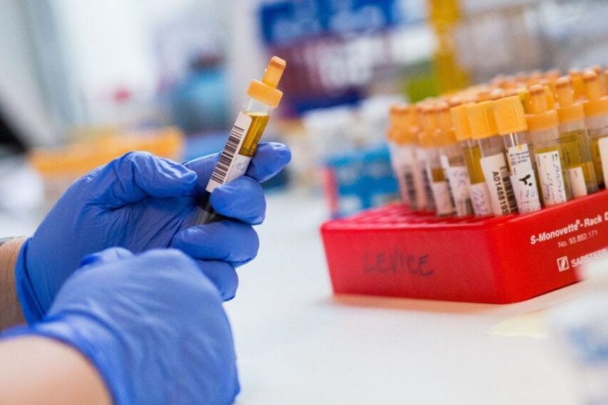 Hygienici eviduju rodinne epidemie a zltacku v Leviciach