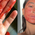 Zeny si na tvar davaju menstruacnu krv lekarka varuje