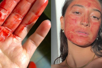 Zeny si na tvar davaju menstruacnu krv lekarka varuje