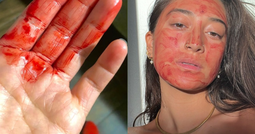 Zeny si na tvar davaju menstruacnu krv lekarka varuje