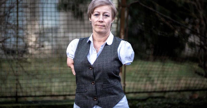 Aby som mohla pracovat staci mi si vyzu ponozky hovori zena bez ruk